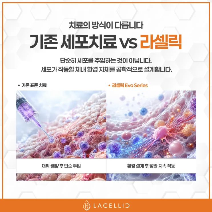 심장질환 의료관광, 새로운 치료 패러다임 Evo Series를 소개합니다