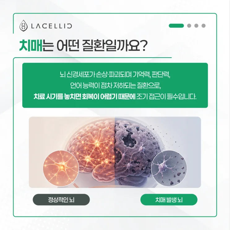 치매, 조기 진단부터 의료관광까지 라셀릭 메디컬 투어 안내
