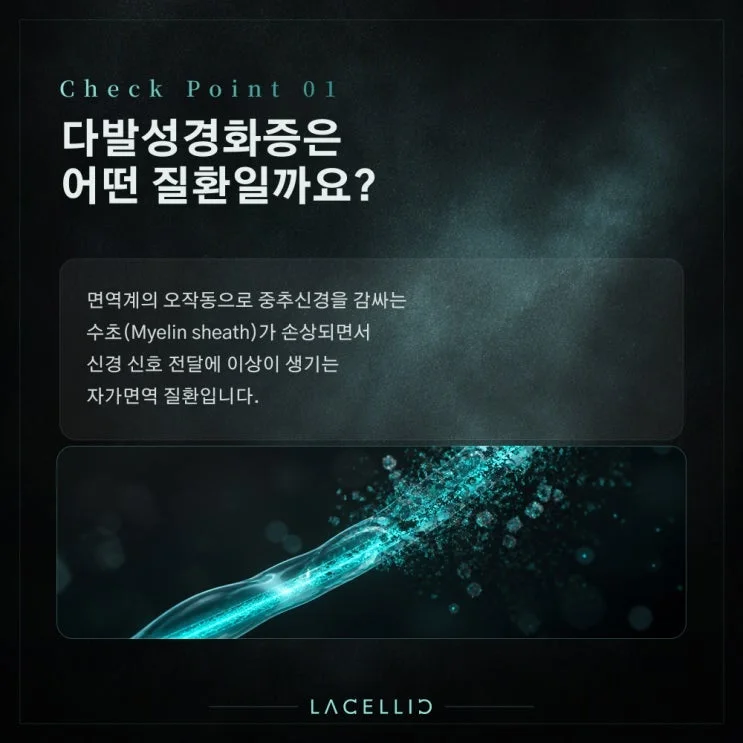 EvoNK·EvoStem 하이브리드 | 다발성경화증, 신경을 감싸는 수초를 오래 바라보는 접근