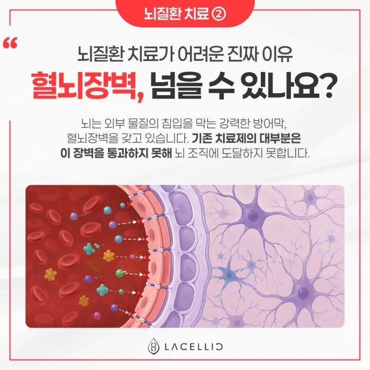 뇌 건강 의료관광, 치료부터 사후관리까지 라셀릭 메디컬 투어