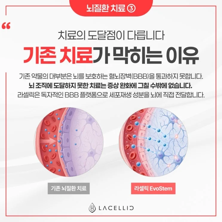 뇌 건강 의료관광, 치료부터 사후관리까지 라셀릭 메디컬 투어