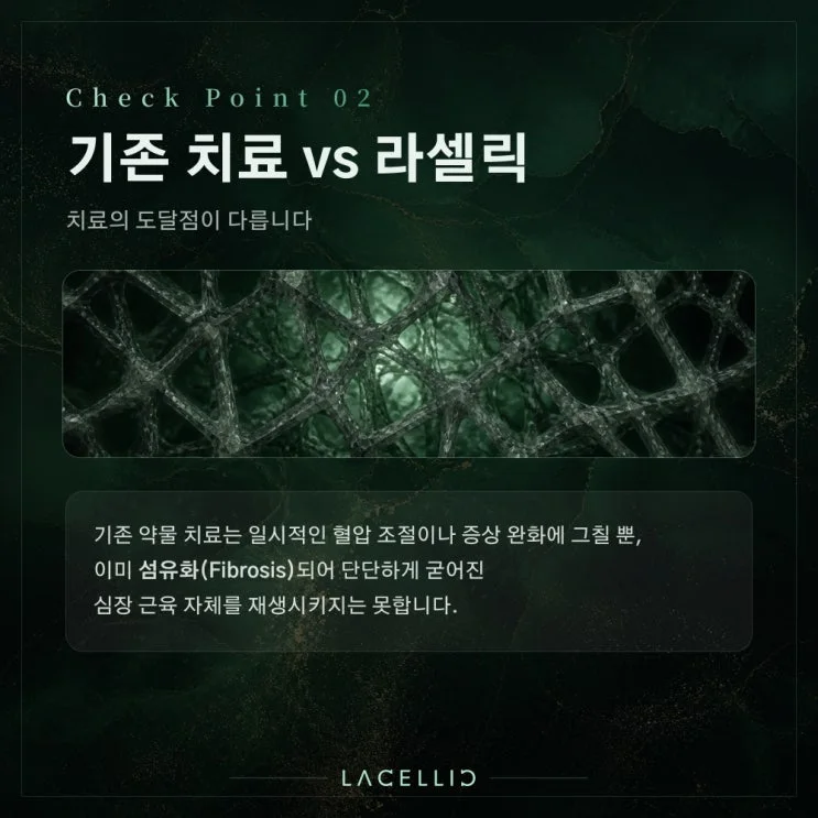 심부전과 세포 재생 치료, EvoStem Promax는 어떤 프로그램일까요?