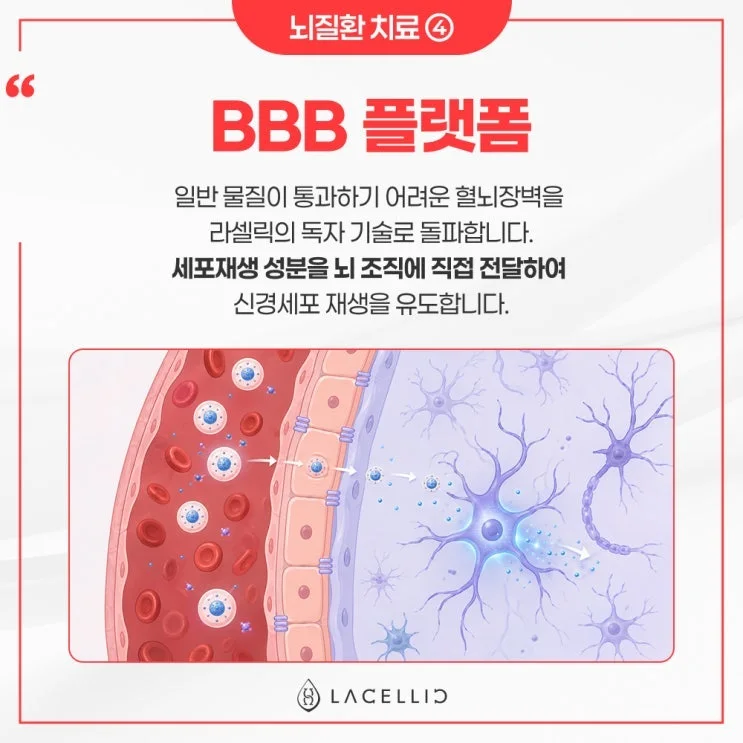 뇌 건강 의료관광, 치료부터 사후관리까지 라셀릭 메디컬 투어