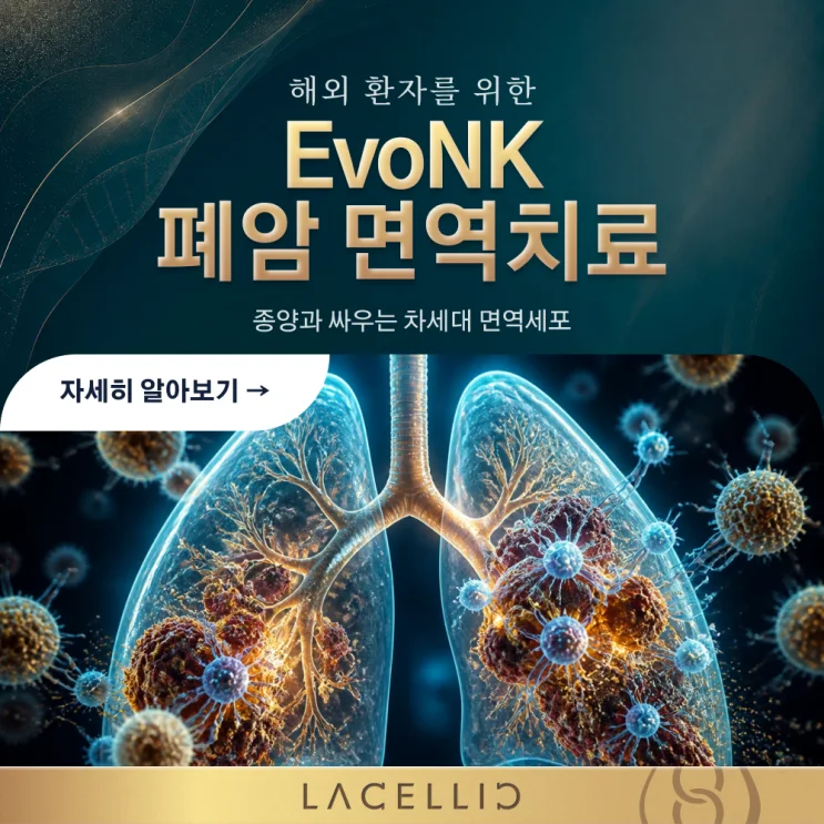 폐암과 면역세포 치료, EvoNK는 어떤 프로그램일까요?
