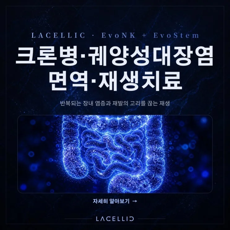 EvoNK·EvoStem 하이브리드 프로그램 | 크론병·궤양성대장염, 반복되는 장 염증을 바라보는 새로운 접근