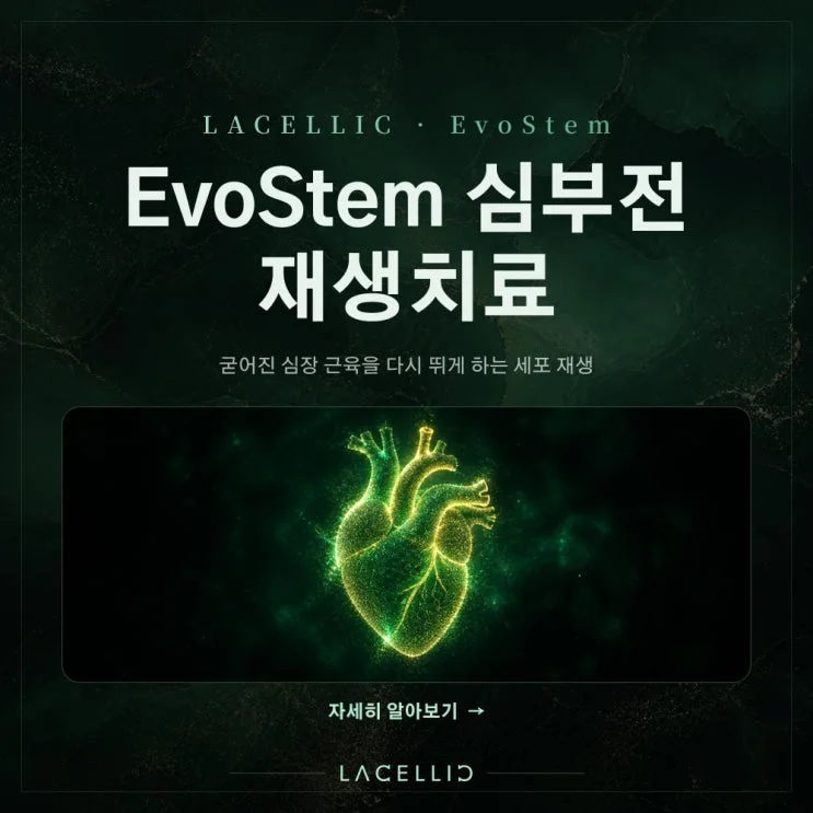 심부전과 세포 재생 치료, EvoStem Promax는 어떤 프로그램일까요?